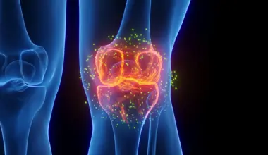 FDA-approved epilepsy drug may help reverse osteoarthritis damage