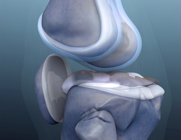 Robotic hip and knee replacement shows no early surgical benefit