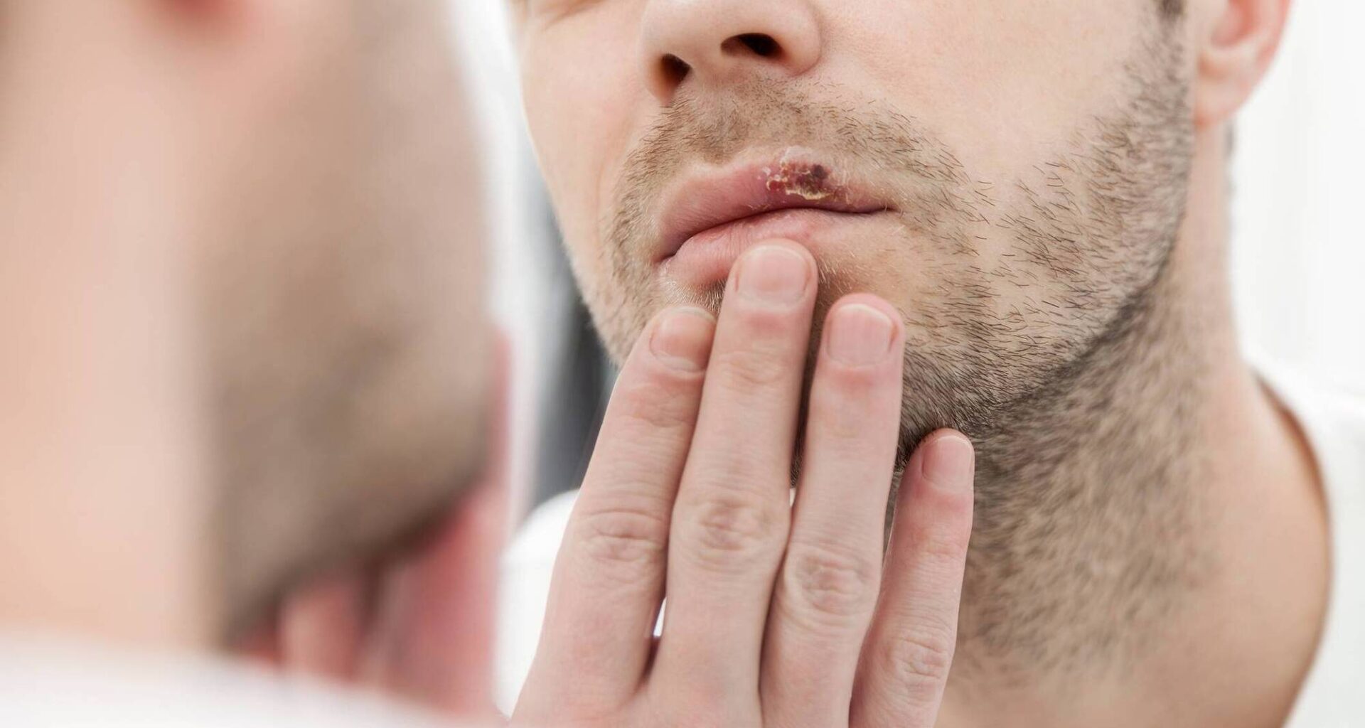 Megan Sheppard: Applying raw garlic to the cold sore is not something that I would recommend Picture: iStock