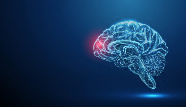 Francesco De Renzis: Deep brain stimulation - timing is critical