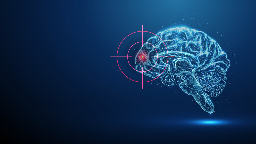 Deep brain stimulation