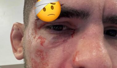Nasty cut forces Gaston Bolanos out of UFC fight