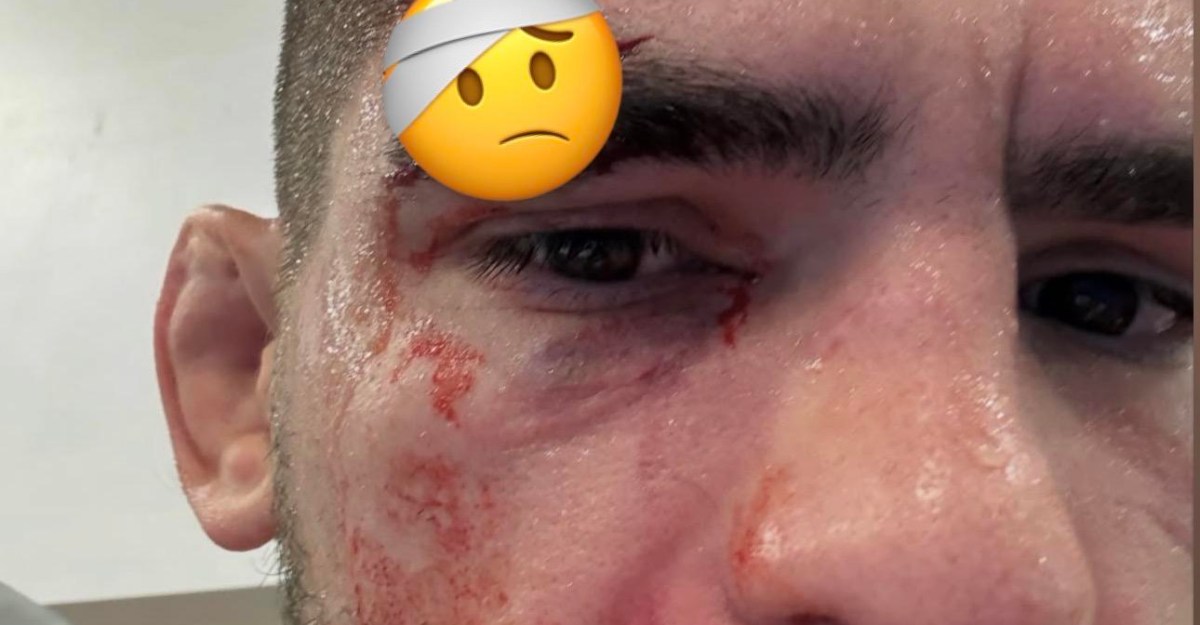 Nasty cut forces Gaston Bolanos out of UFC fight