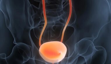 Simple urine test can accurately diagnose and track bladder cancer