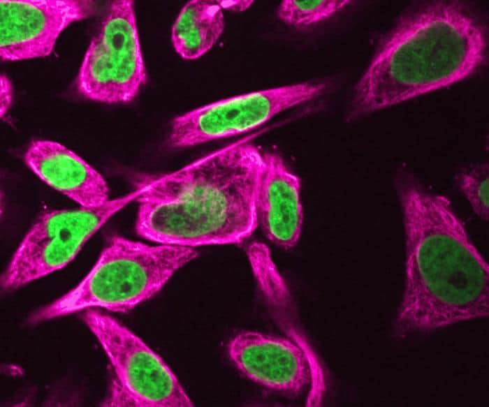 Earth's gravity and magnetism have unexpected effects on the human genome and mitochondria – Physics World