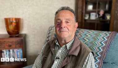 Paul Sutton is looking straight at the camera. He has short, curly, grey hair and a freckled face. He has a large birth mark on his right cheek. He is wearing a green and white striped shirt and a khaki, waxed jacket type gilet. He is sat in a denim blue armchair.