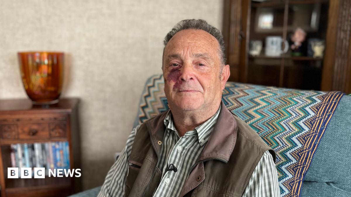 Paul Sutton is looking straight at the camera. He has short, curly, grey hair and a freckled face. He has a large birth mark on his right cheek. He is wearing a green and white striped shirt and a khaki, waxed jacket type gilet. He is sat in a denim blue armchair.