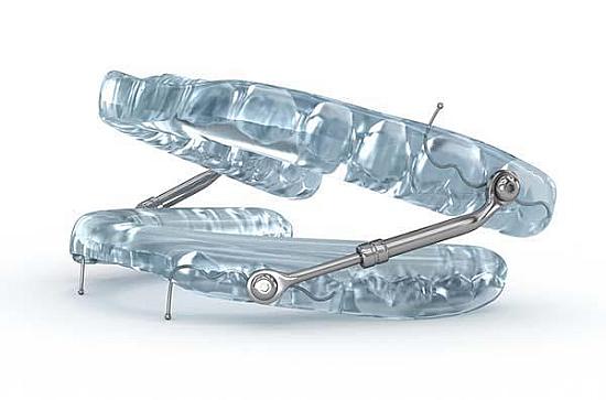 For sleep apnea, a dental device may be as effective as CPAP