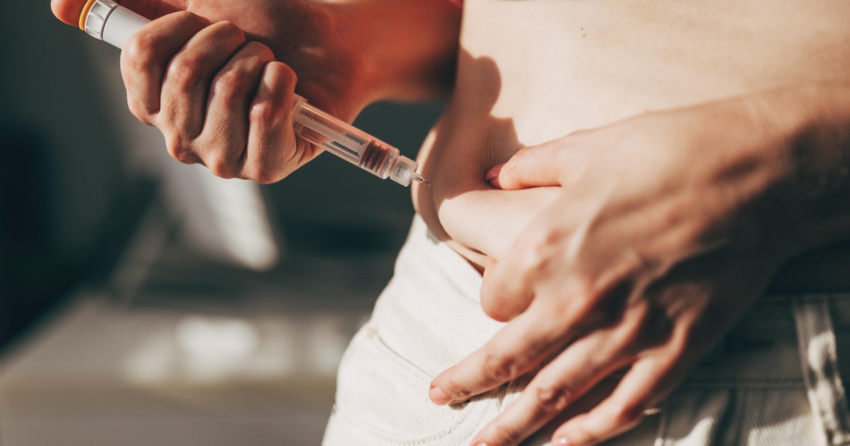 More people now use GLP-1s for weight loss than for other health conditions, research finds