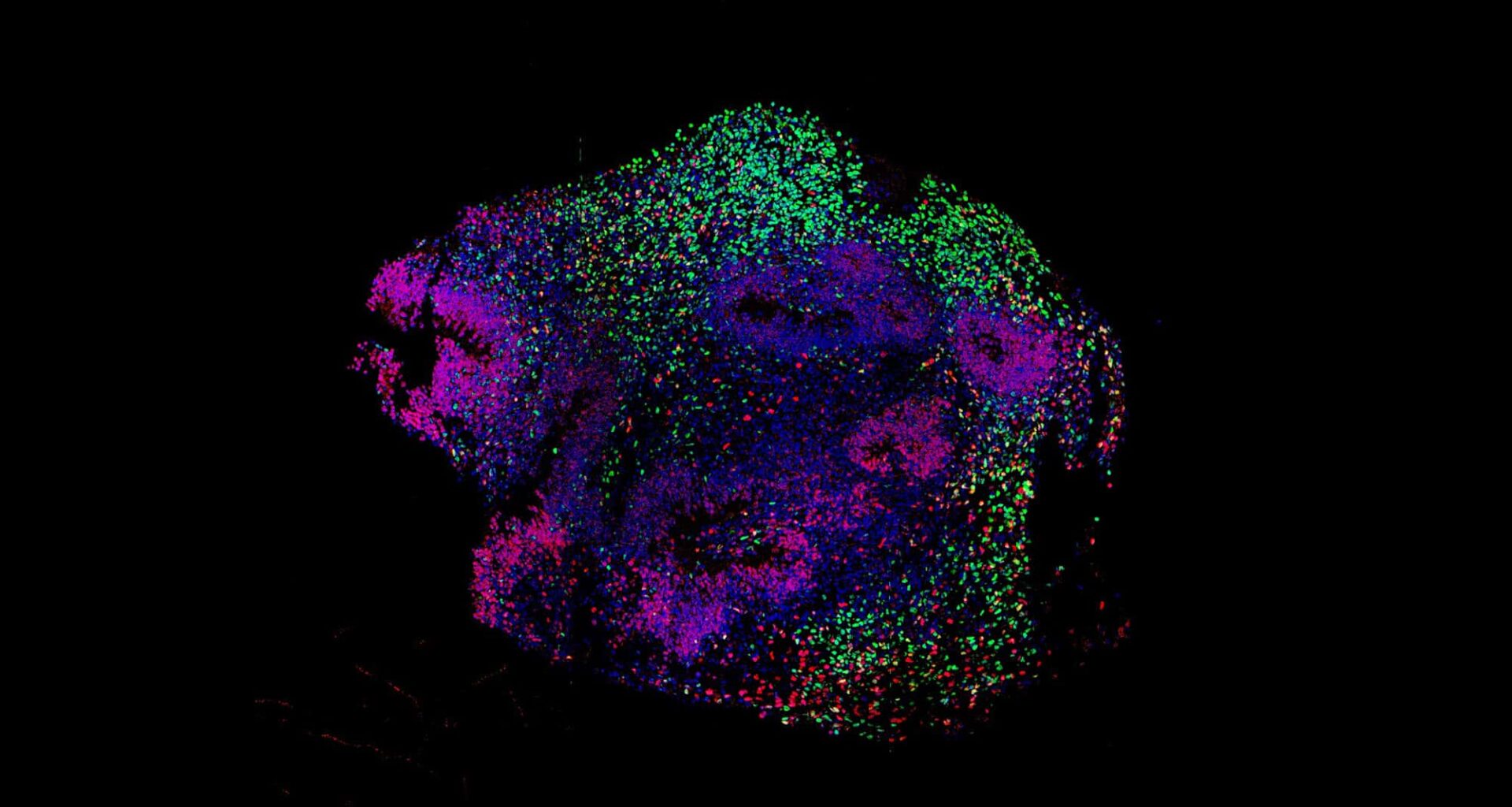 How Anesthesia Affects Neural Activity