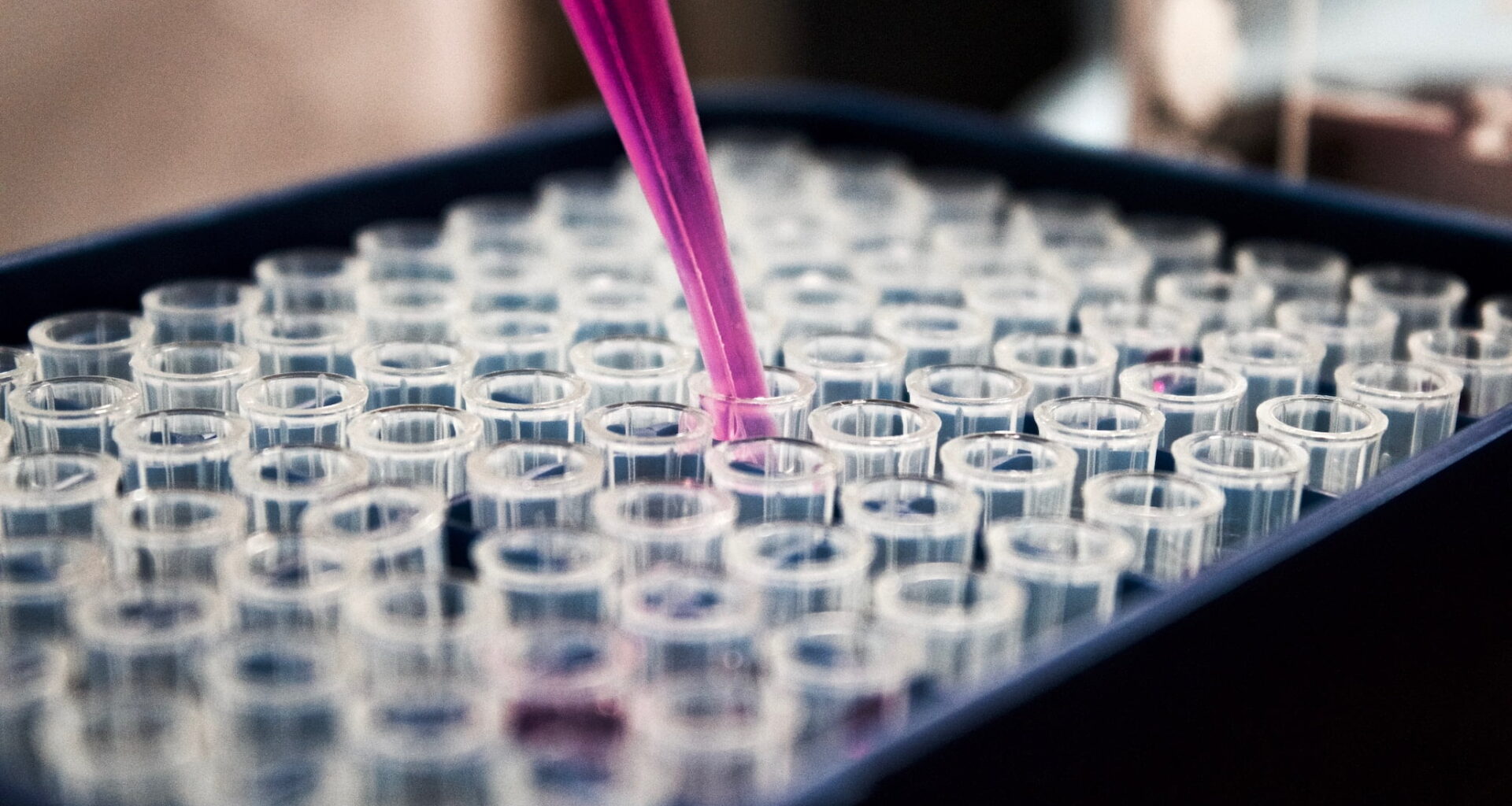 UNC School of Medicine | Researchers identify new pathway that helps HIV hide in the body despite treatment