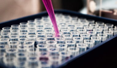 UNC School of Medicine | Researchers identify new pathway that helps HIV hide in the body despite treatment