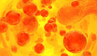 Severe Pneumonia May Signal Undiagnosed Blood Cancer