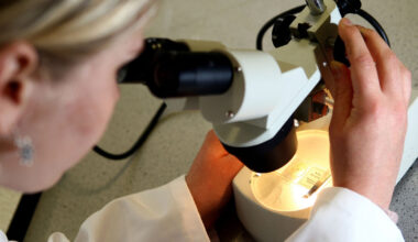 Ireland’s quiet revolution of diagnosing Alzheimer’s