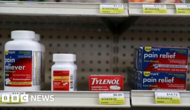 Trump will reportedly link autism to Tylenol