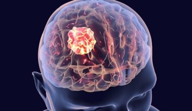 ‘Rogue’ DNA rings identified as drivers of aggressive brain cancer