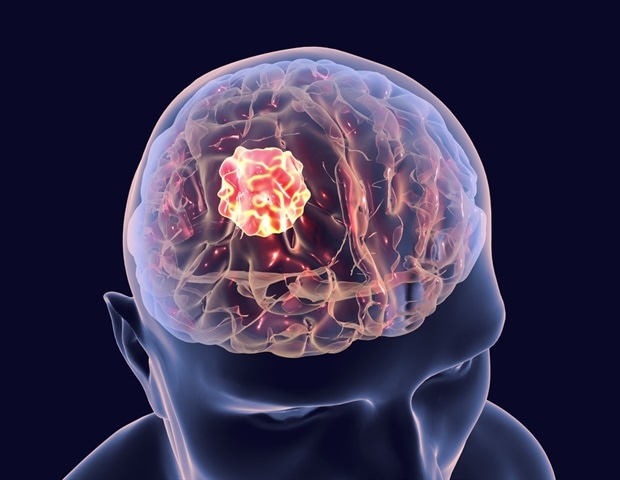 ‘Rogue’ DNA rings identified as drivers of aggressive brain cancer