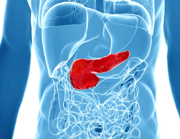 New genetic test redefines diagnosis and management of hereditary pancreatitis