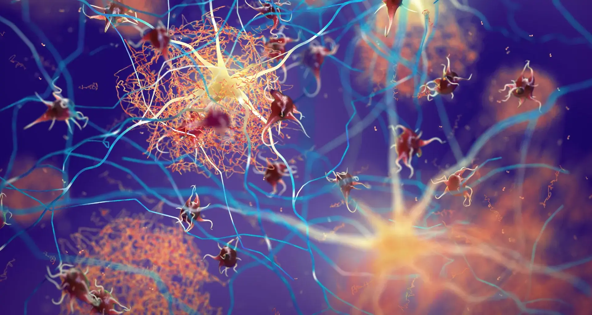 Hidden Alzheimer’s warning signs found in Parkinson’s patients without dementia