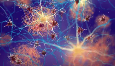 Hidden Alzheimer’s warning signs found in Parkinson’s patients without dementia