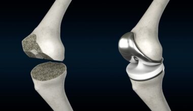 Johnson and Johnson to spin off orthopaedics market