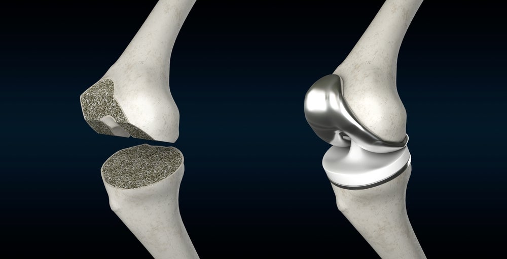 Johnson and Johnson to spin off orthopaedics market