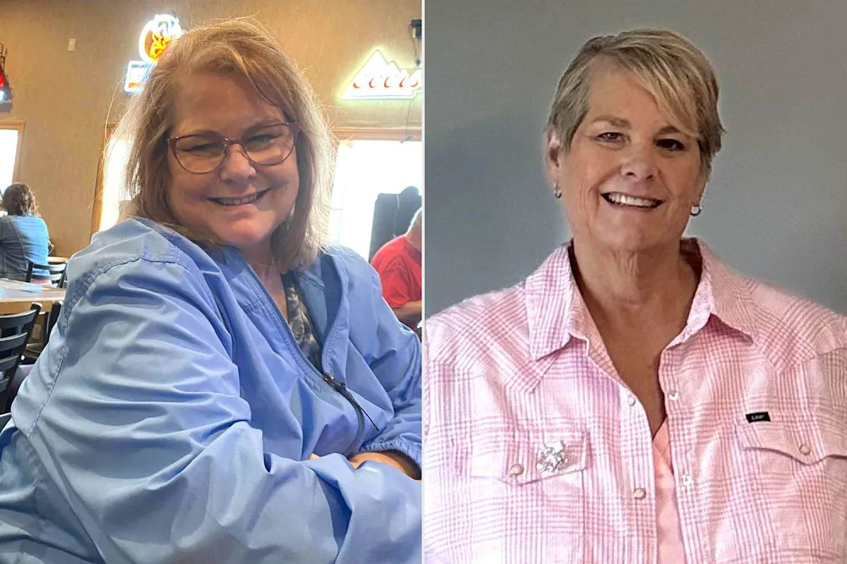 She Had a Bad Back and Doctor's Orders to Lose Weight. How One Woman Dropped 80 Lbs. with 'Little Exercise' (Exclusive)
