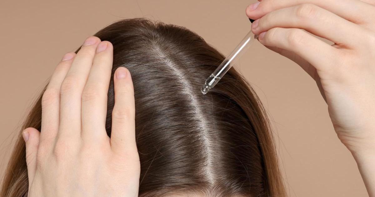 Dermatology association warns against non-medical prescription of hair drugs