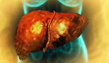 A Henna Plant Extract Could Be A Surprisingly Effective Treatment For Liver Fibrosis