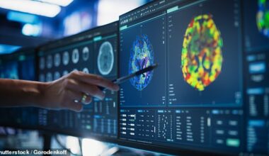 CT head scans are commonly prescribed medical tests used to diagnose neurological issues like head trauma and stroke (stock)