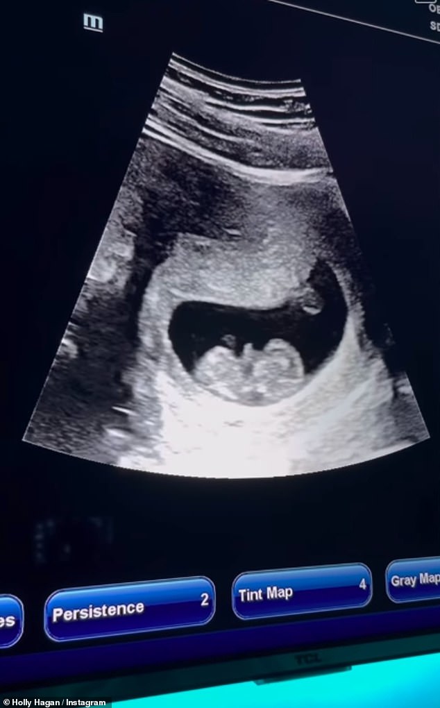 The former Geordie Shore star, 33, revealed she is expecting her second child with her husband Jacob Blyth with a sweet Instagram video on Sunday