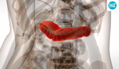 On World Pancreatic Cancer Day 2025, oncologist shares 5 signs to watch out: Unexplained weight loss to changes in stool