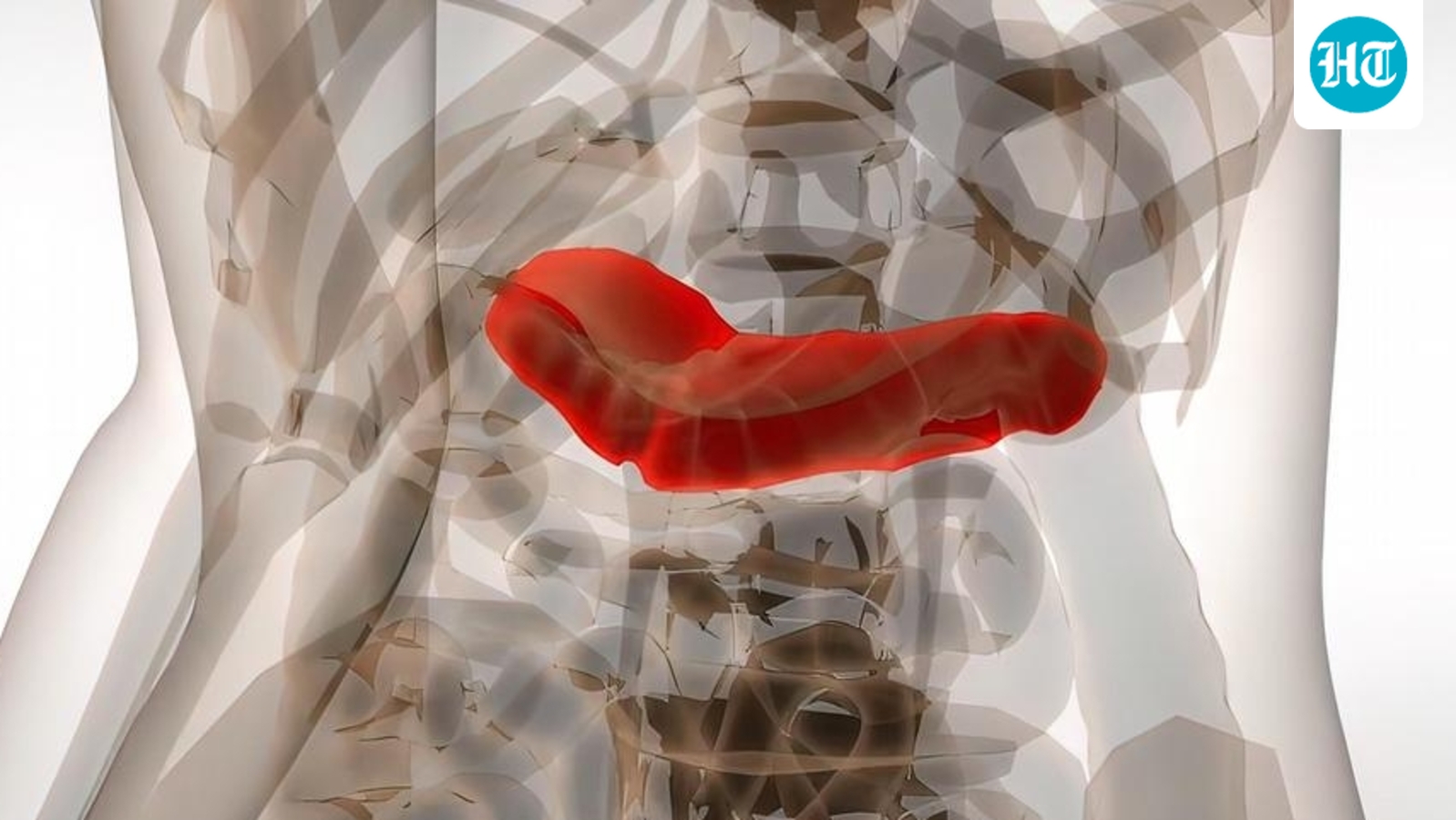 On World Pancreatic Cancer Day 2025, oncologist shares 5 signs to watch out: Unexplained weight loss to changes in stool