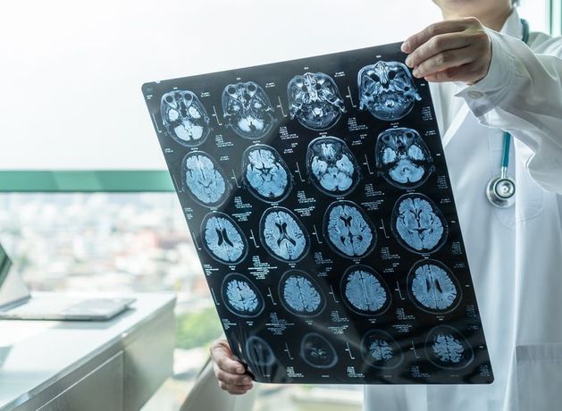 People suffering from Parkinson’s disease feel pitied and misjudged, Irish study finds