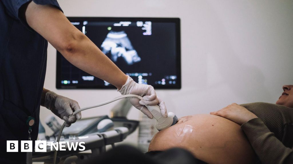 Warning over dangerous high street baby scans