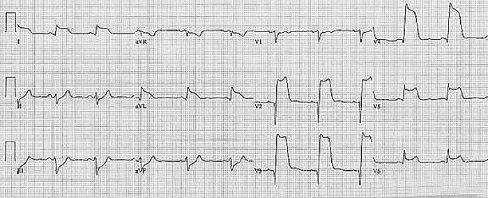 ECG readout showing heart activity, illustrating the theme of Dr. Google versus a real doctor's medical insights.