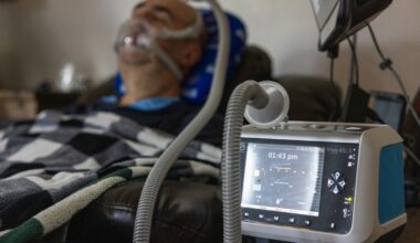 Getting a ventilator can be a nightmare. Medicaid cuts may make it worse : Shots