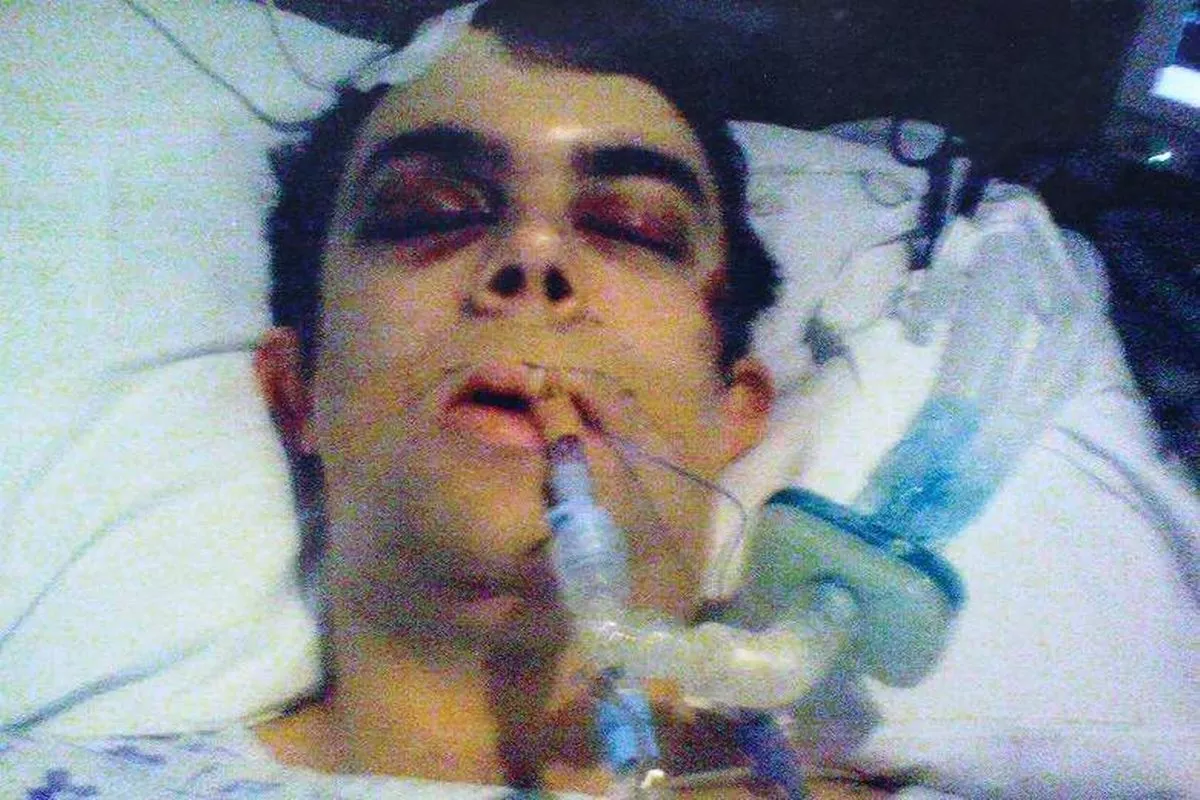Mark Blanco lies in Intensive care at the Royal London hospital following "fall" 
