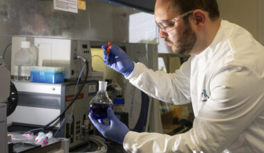 Galway scientists growing ‘mini brains’ in labs to aid research