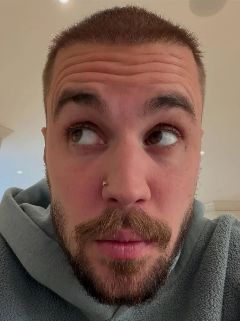 He later shared a funny selfie. Instagram/Justin Bieber