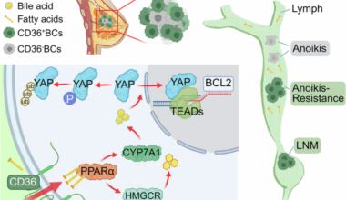 Elevated CD36 drives lymph node metastasis of breast cancer by activating Hippo-YAP signaling-mediated anoikis resistance