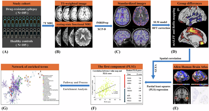 Transcriptomic decoding of regional cortical vulnerability to drug-resistant epilepsy using 7T MRI