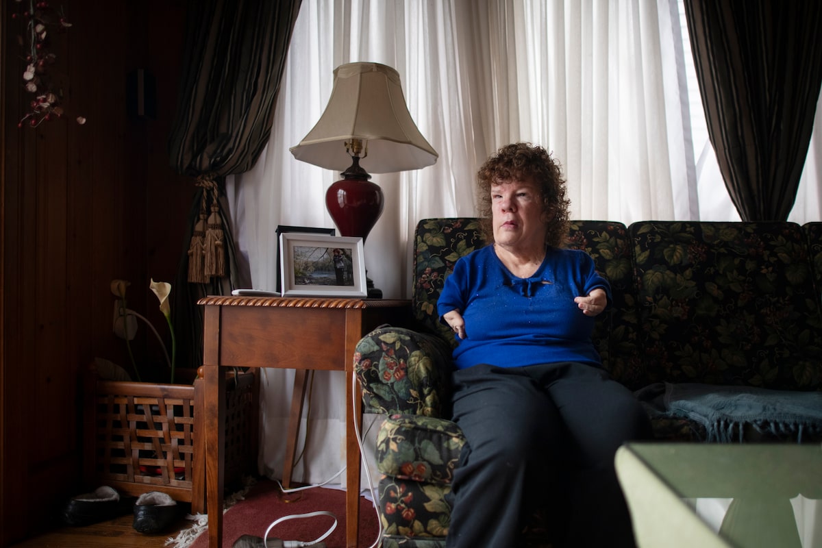 Morning Update: Revisiting thalidomide survivors