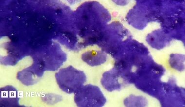 A close-up of The Yellow Smiley Face which is situated on a first-class stamp, on a micro dot on the eye of the late Queen Elizabeth II