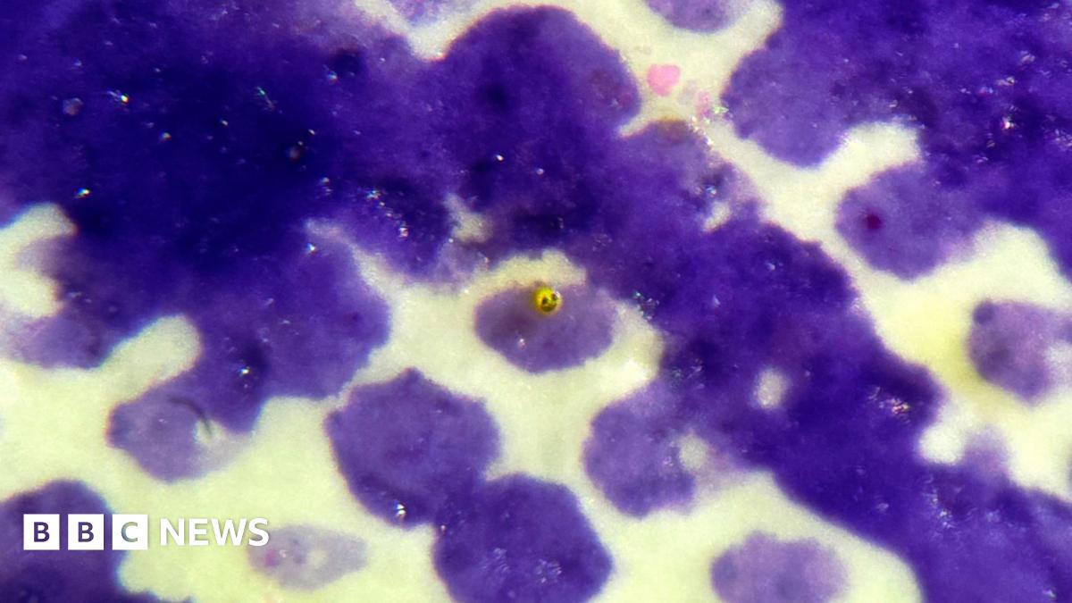 A close-up of The Yellow Smiley Face which is situated on a first-class stamp, on a micro dot on the eye of the late Queen Elizabeth II