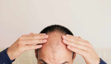 Is this the end of baldness? This stock jumps 50% on breakthrough