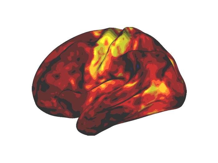 WashU Medicine researchers find stimulant medications don’t affect attention-controlling regions of the brain, as previously thought. Brain scans show the drugs affect brain areas involved in wakefulness and reward, highlighted in yellow and orange. WashU Medicine researchers find stimulant medications don’t affect attention-controlling regions of the brain, as previously thought. Brain scans show the drugs affect brain areas involved in wakefulness and reward, highlighted in yellow and orange.