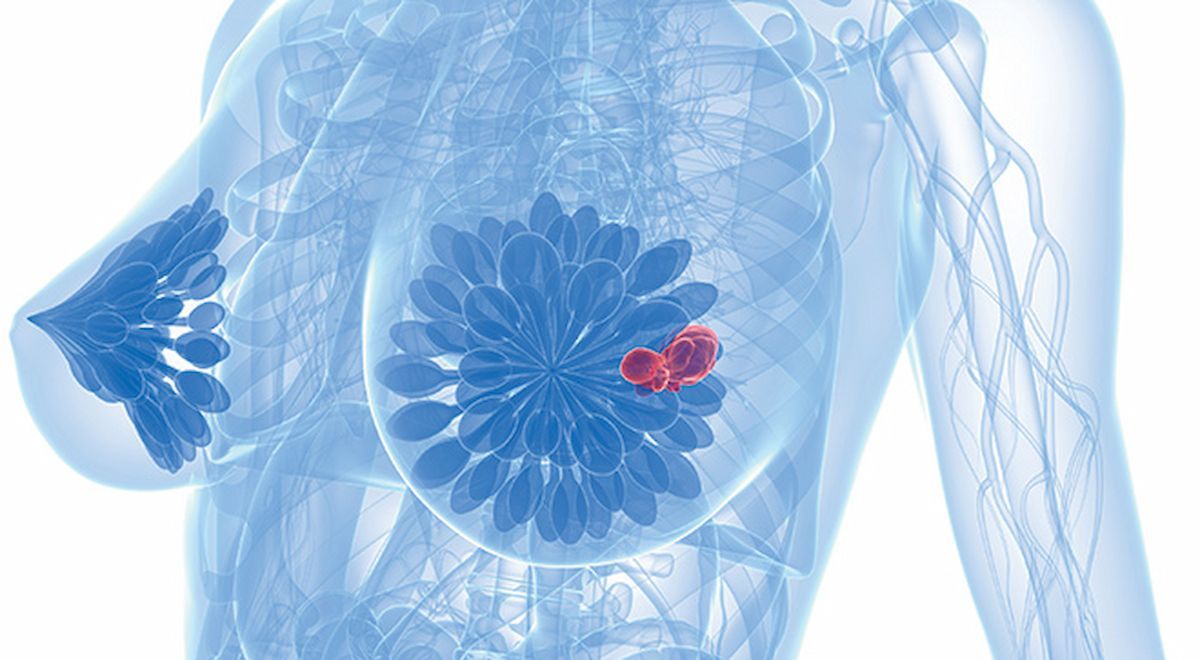 The COMPASSION-37 study is the second international registrational study for cadonilimab following an ongoing trial in hepatocellular carcinoma.