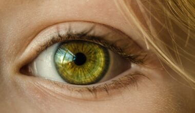 MIT study shows how vision can be rebooted in adults with amblyopia | MIT News