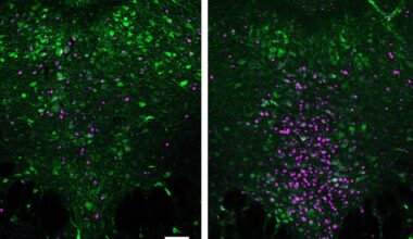 Too sick to socialize: How the brain and immune system promote staying in bed | MIT News